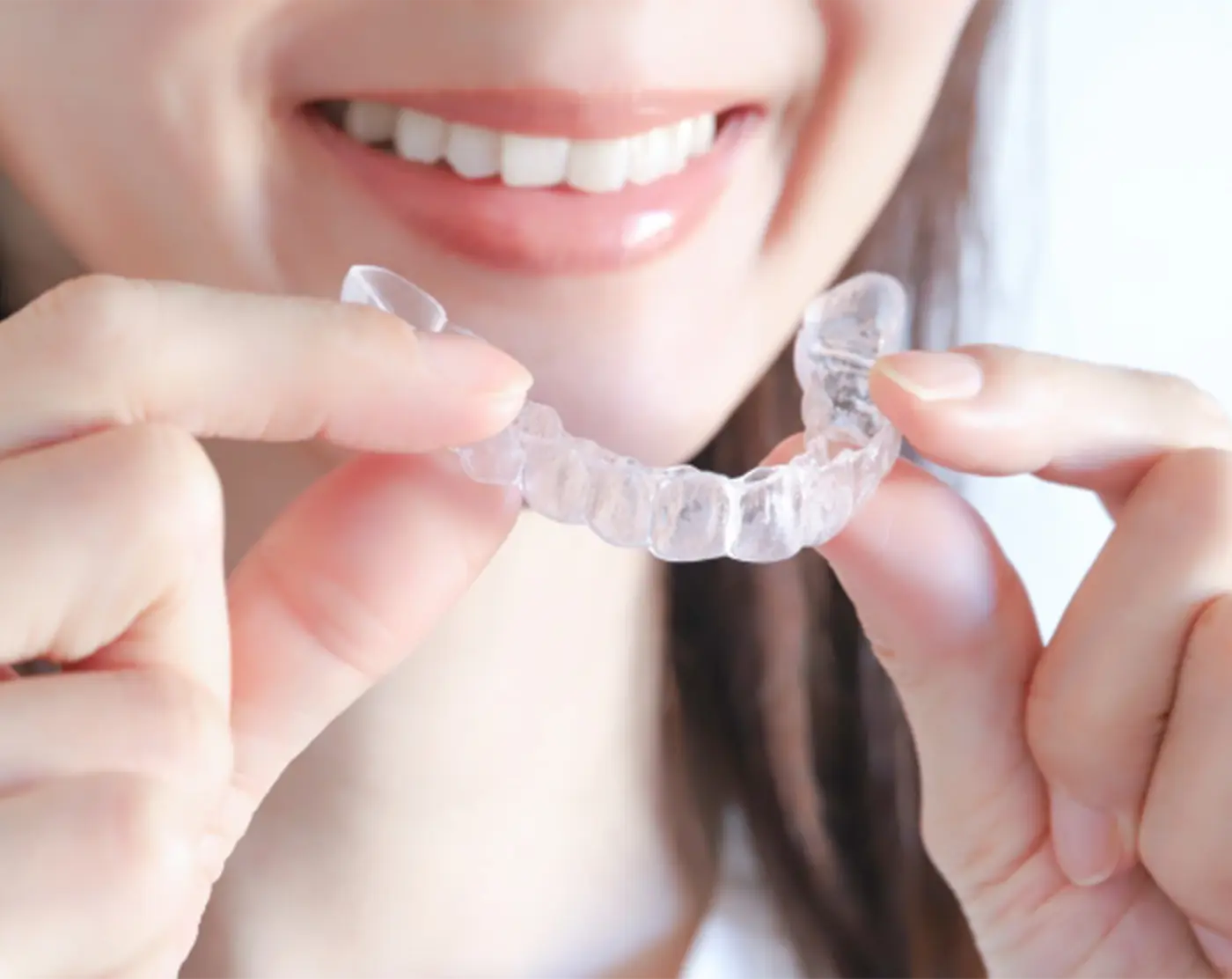 マウスピース矯正のイメージ