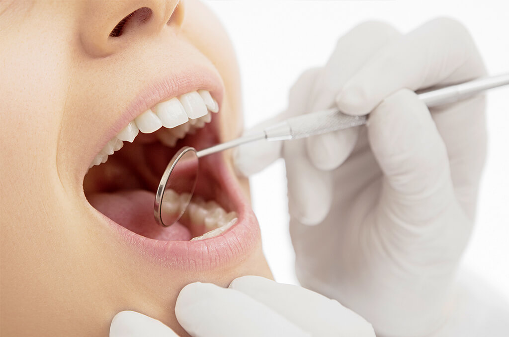 歯周病検査ののイメージ